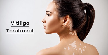 Skin Treatment in Ahmedabad